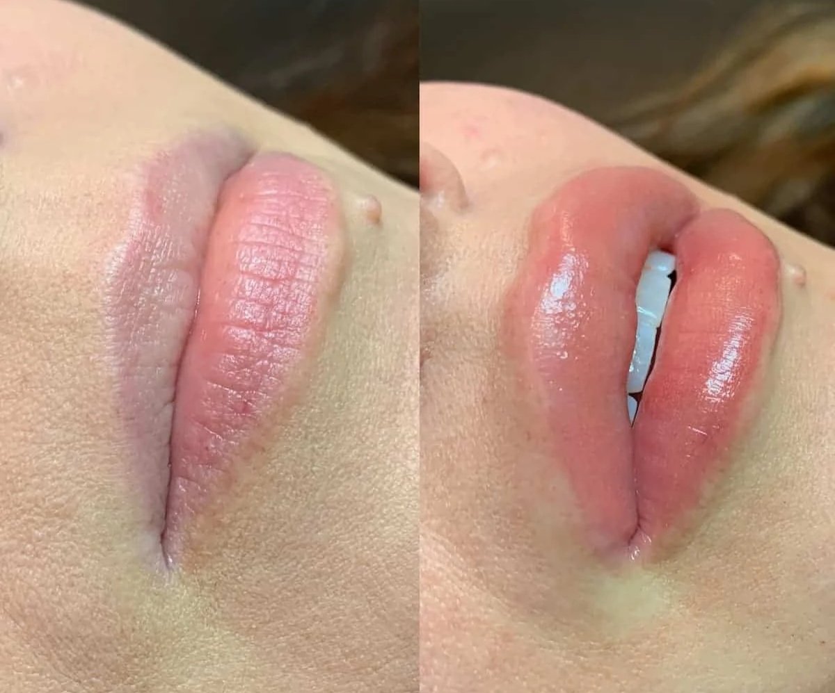 Close-up of lips before and after applying lip gloss, showing transformation from matte to shiny, moist lips.