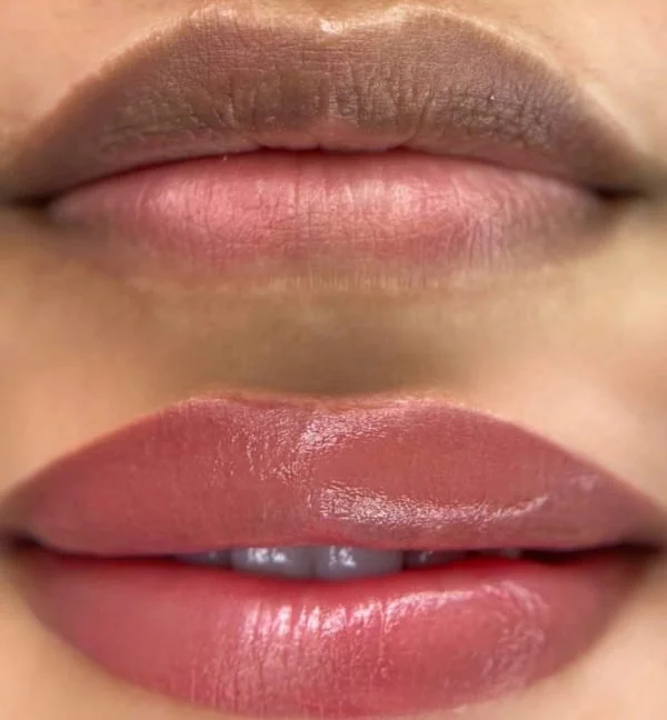 Close-up of lips, showing a before-and-after comparison of lip neutralization.