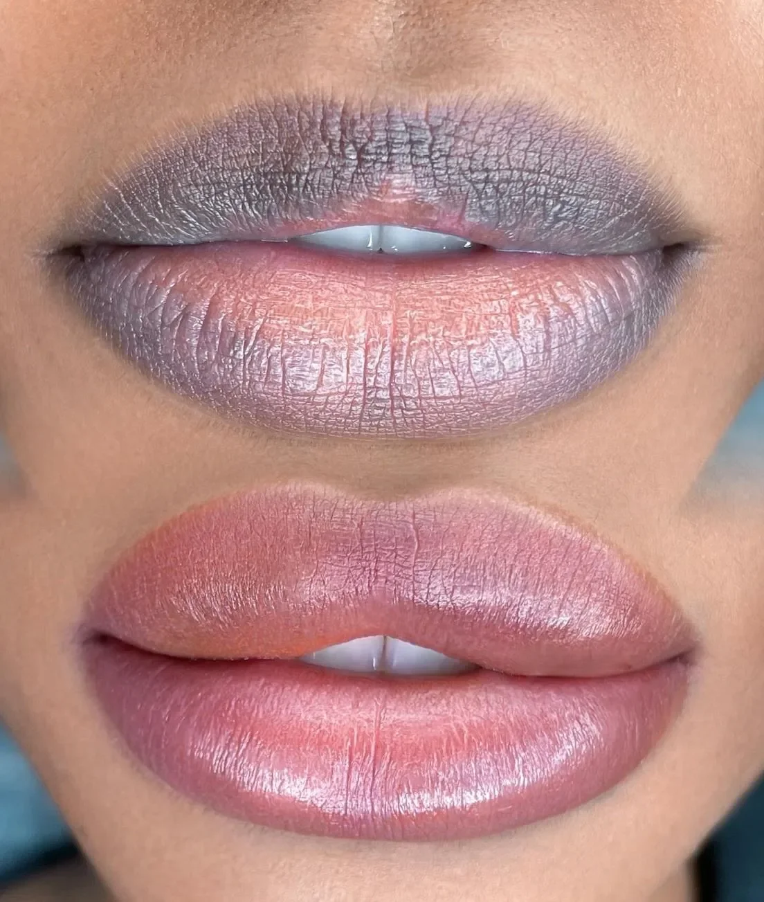 Lip-Blushing-for-Dark-Lips-Melbourne.webp