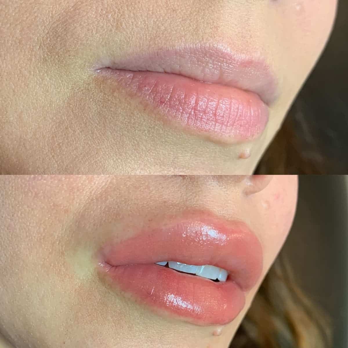 Close-up of lips before and after applying gloss or lipstick, showing smoother, shinier lips in the second image.