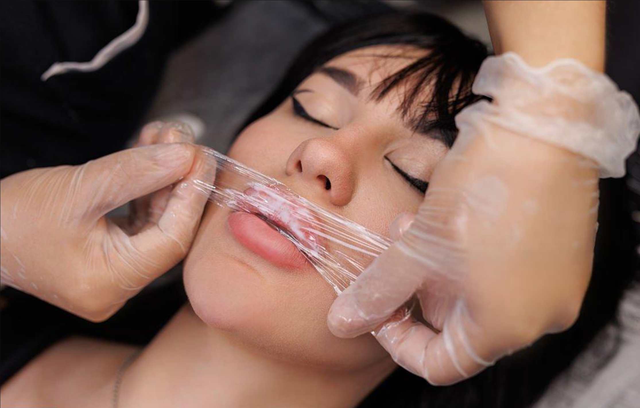 A person is receiving a cosmetic procedure involving clear plastic wrap being applied or removed from their face, with hands wearing gloves.