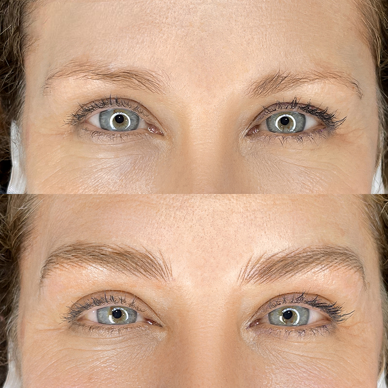 Close-up of a woman's face showing a comparison of her eyebrows before and after cosmetic permanent makeup nano brows.