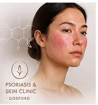Adult with skin flushing illustrating the possible effects of histamine intolerance on skin