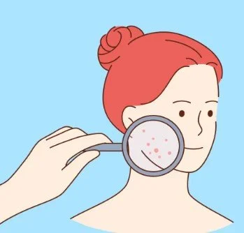 The Gut–Skin Axis: How Gut Dysbiosis Drives Acne Breakouts