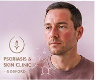 Illustration showing the possible connection between rosacea, gut health and the microbiome