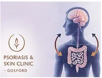 The Gut-Brain-Skin Axis and Psoriasis: Understanding the Connection