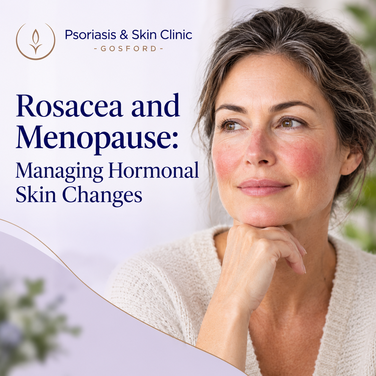 Rosacea &amp; Menopause: Understanding Hormonal Changes
