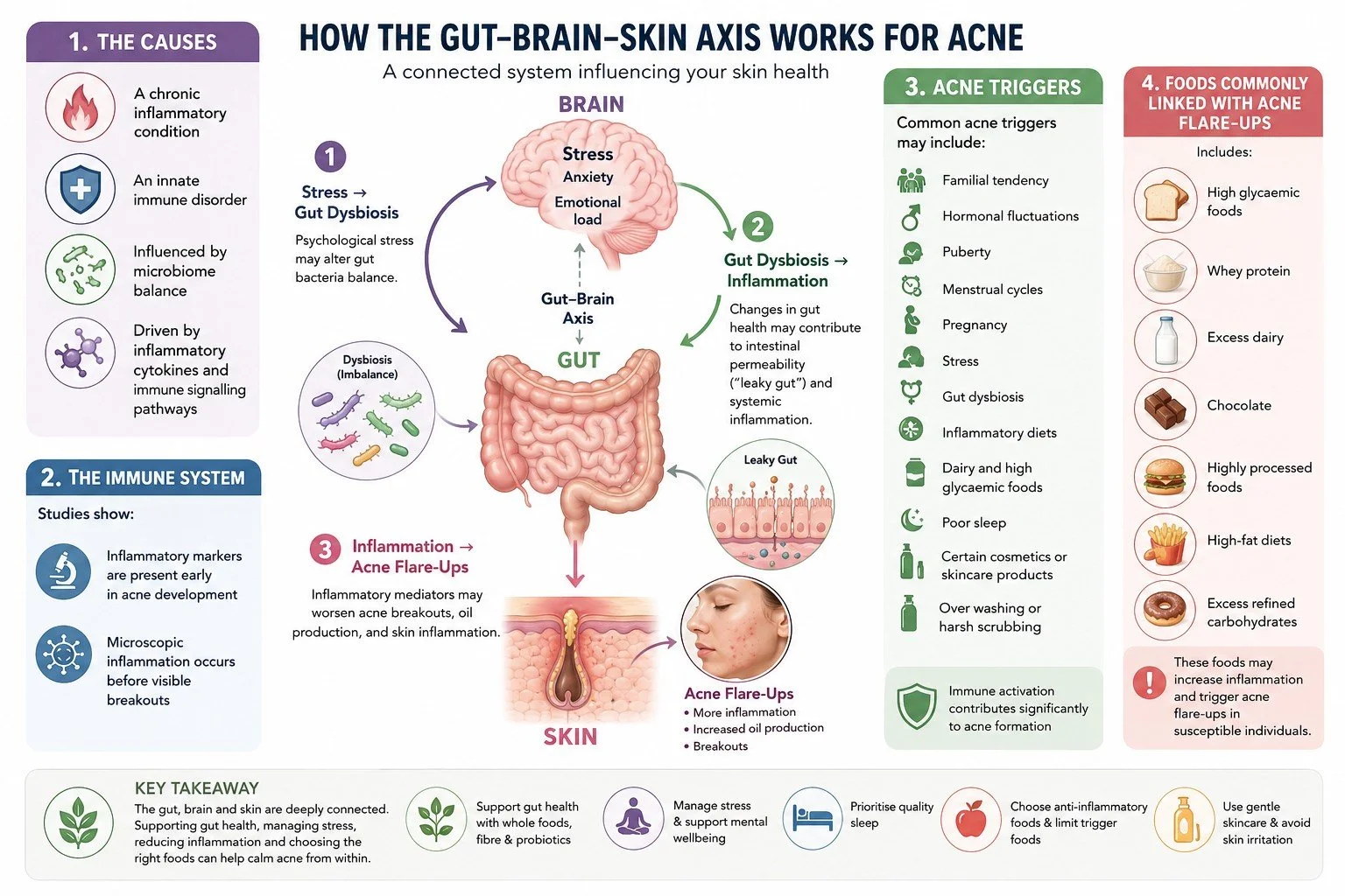Image show the gut, brain and skin connection for acne. The causes and triggers of acne. Foods linked to flare-ups. The immune system involvement. There are tips that can help improve how the skin can heal.