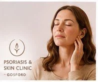 Woman with rosacea illustrating possible hormonal influences on skin health