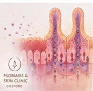 Illustration showing intestinal permeability and its possible connection with skin health