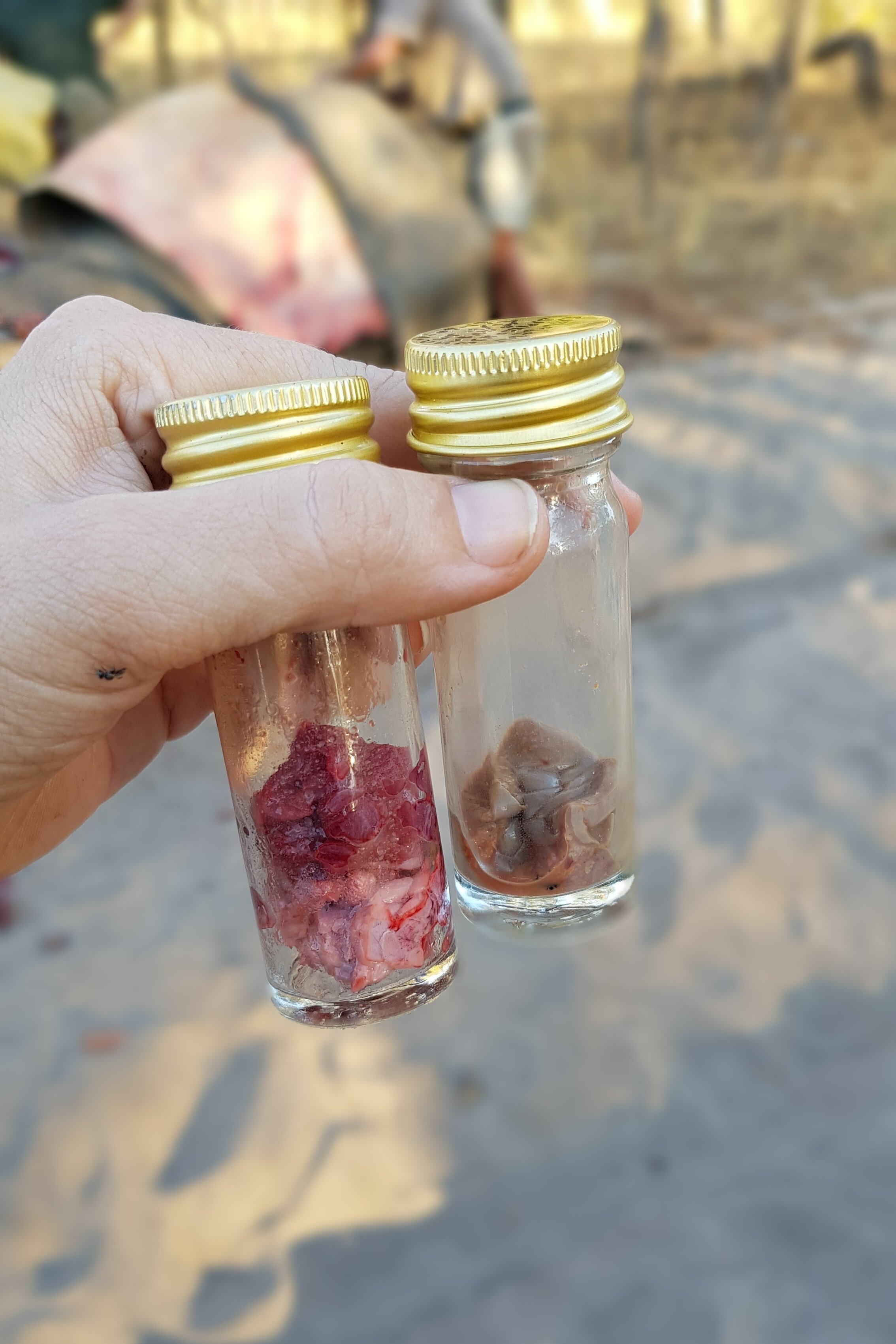 Collecting tissue samples to determine cause of death