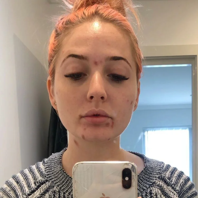 Paris during active addiction in 2020, with pink hair