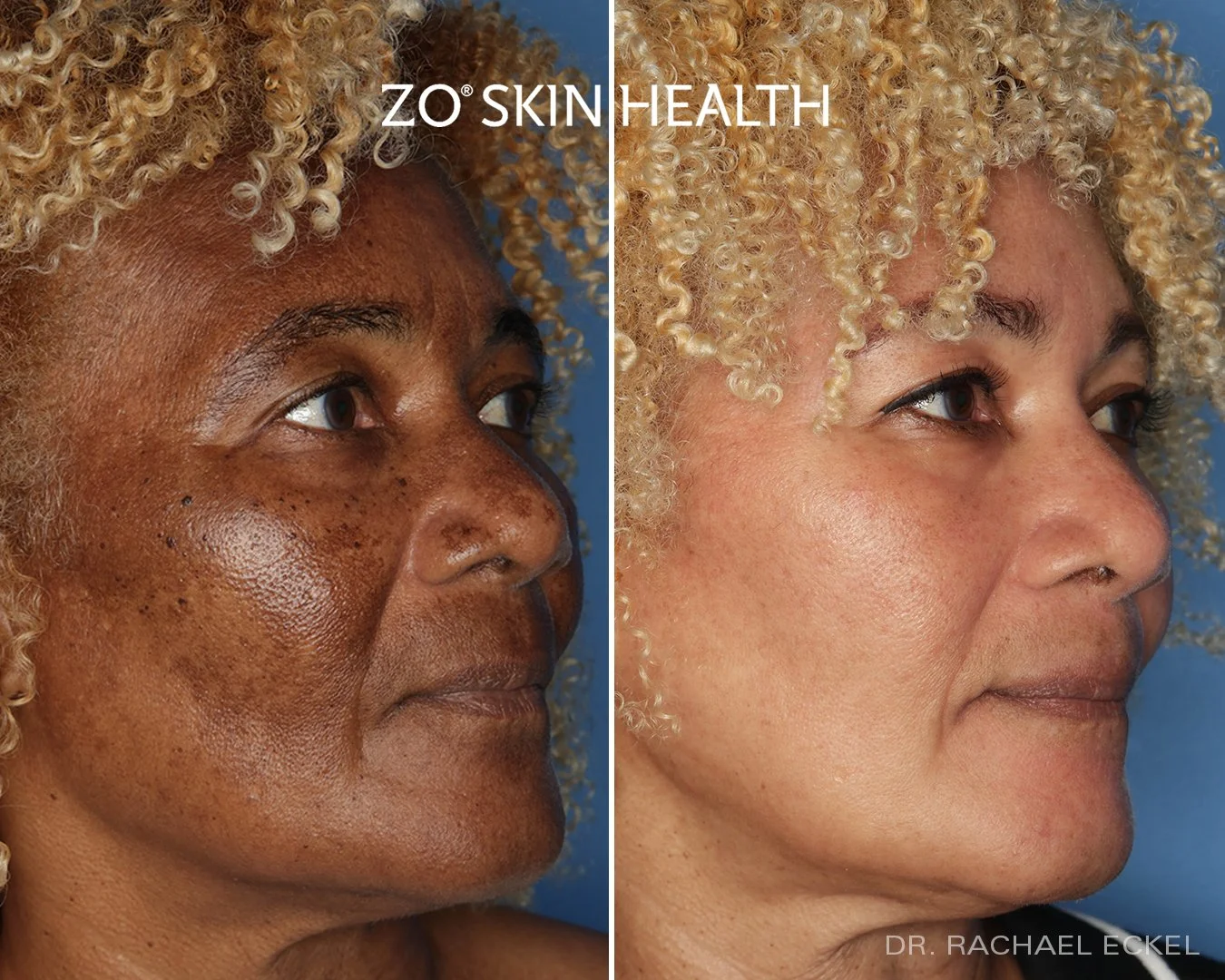 ZO Product Line — Dermedica Medical