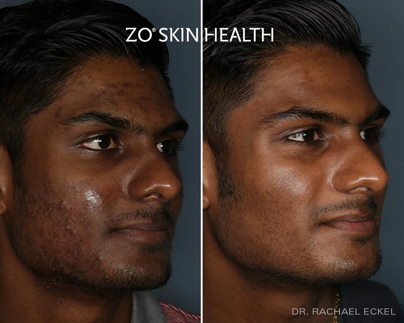 ZO Product Line — Dermedica Medical