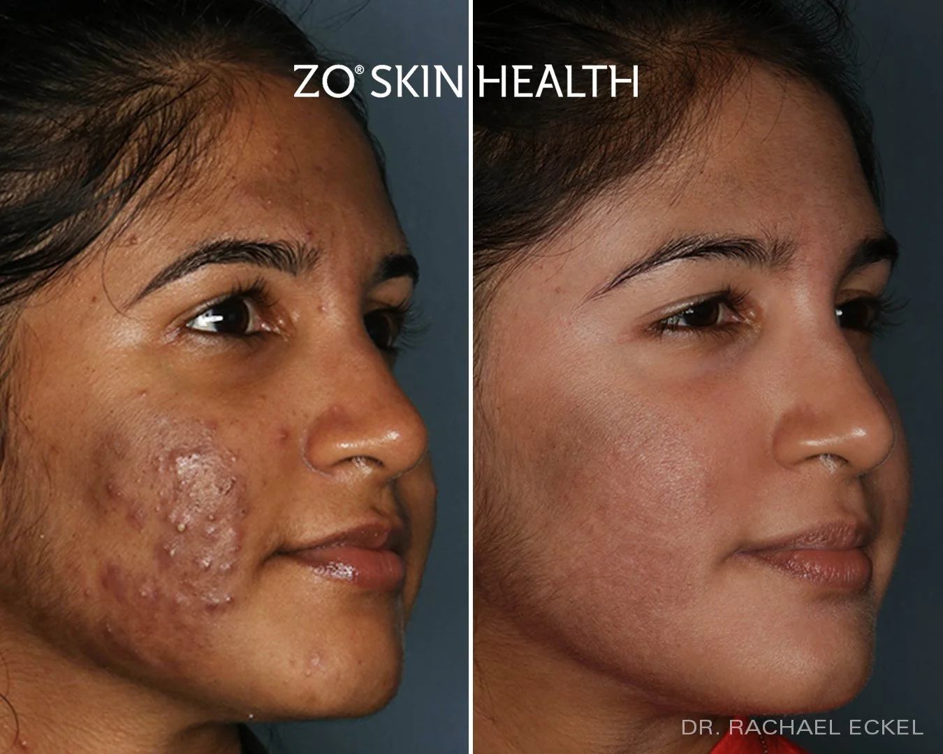 ZO® Skin Health — Dermedica Medical