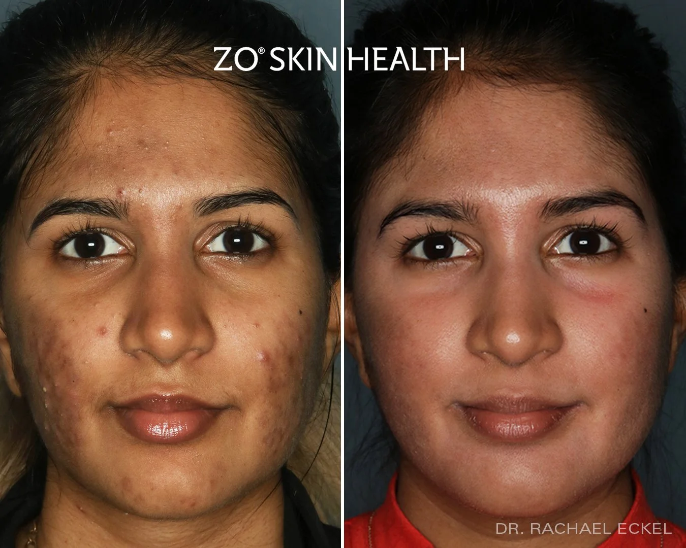 ZO® Skin Health — Dermedica Medical