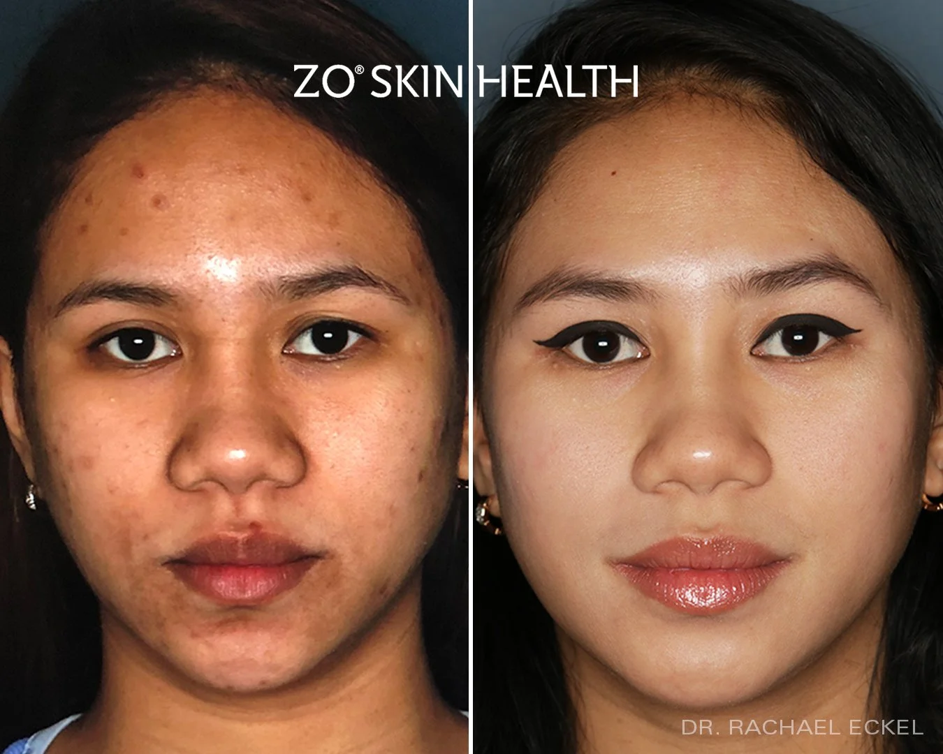 ZO Product Line — Dermedica Medical
