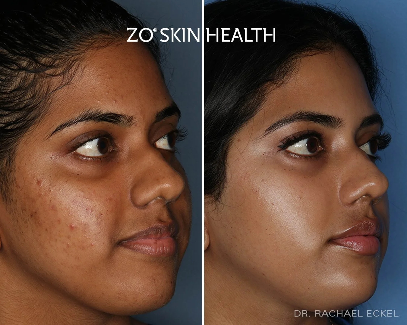 ZO Product Line — Dermedica Medical