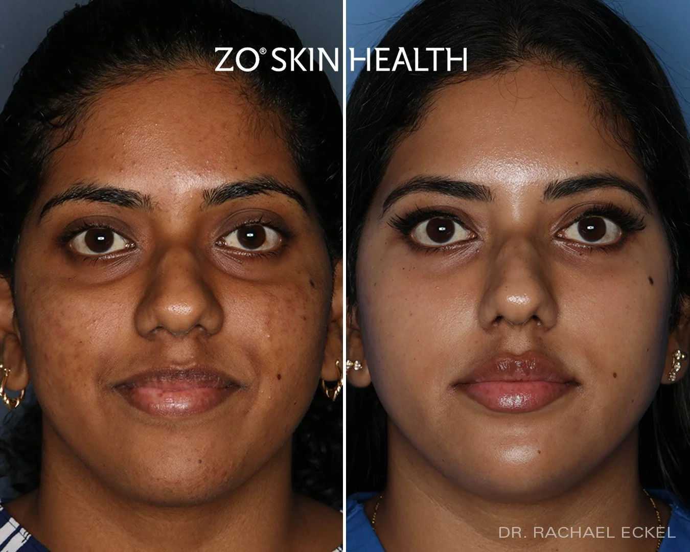 ZO Product Line — Dermedica Medical