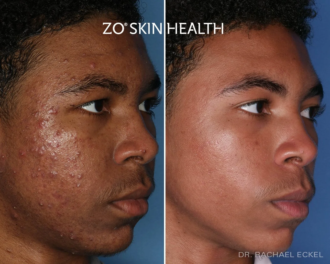 ZO Product Line — Dermedica Medical