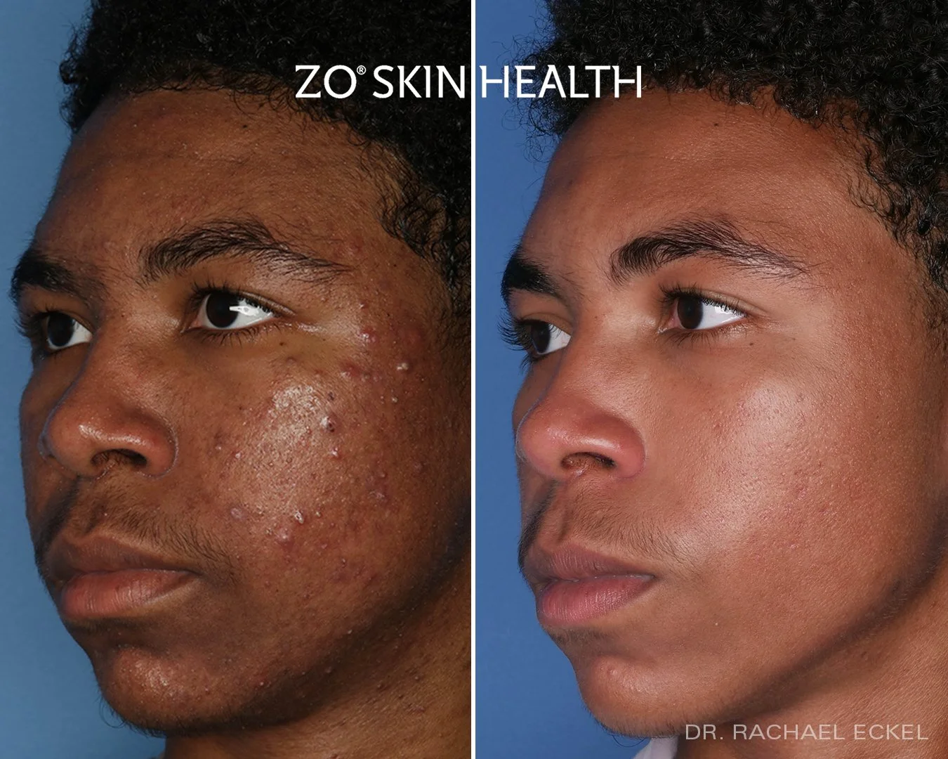 ZO Product Line — Dermedica Medical