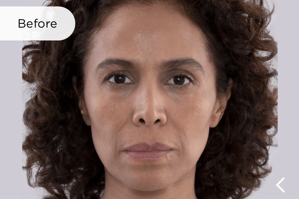 Before, Marina aged 47