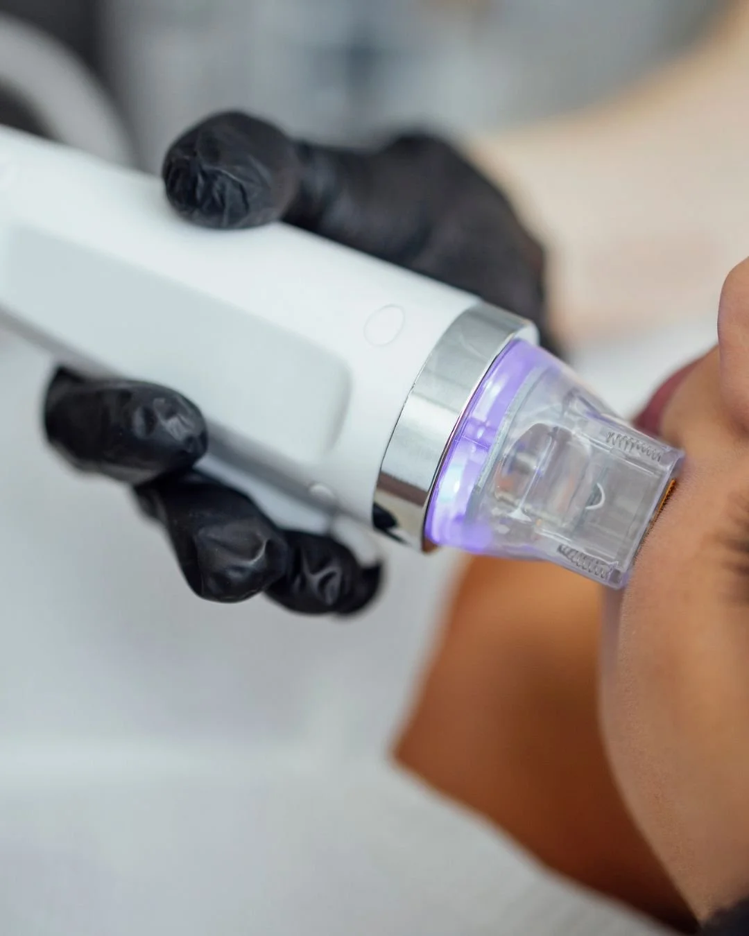 Why “Skin Tightening” Is One of the Biggest Myths in Aesthetics — And Why Only a Facelift Truly Tightens Skin