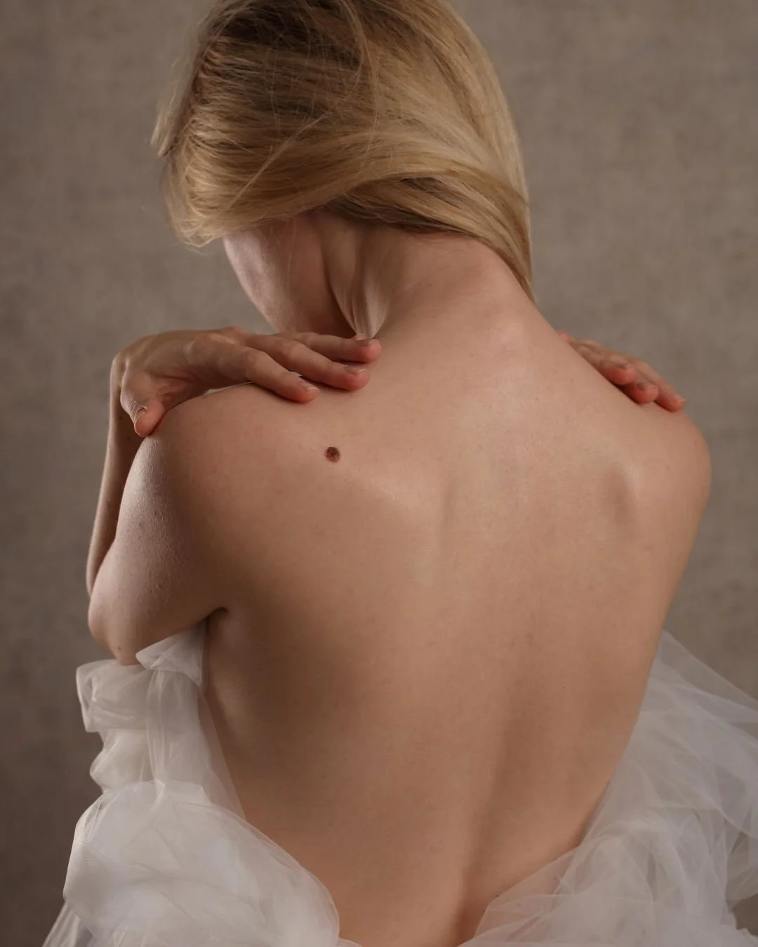 Skin Tag Removal in Hale, Altrincham at a doctor-led award winning clinic