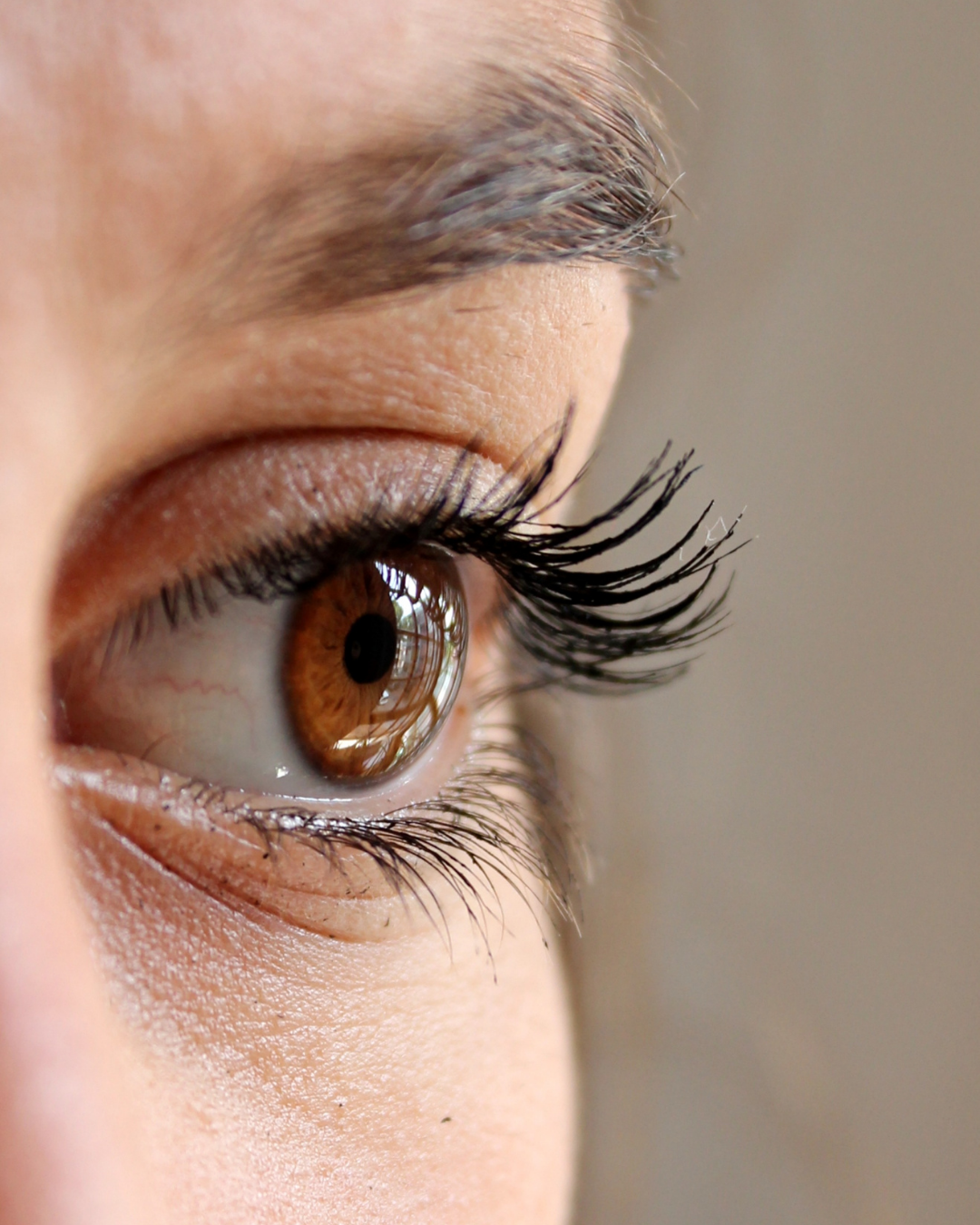 Why I Don't Offer Tear Trough Filler: The Four Causes of Under-Eye Shadows
