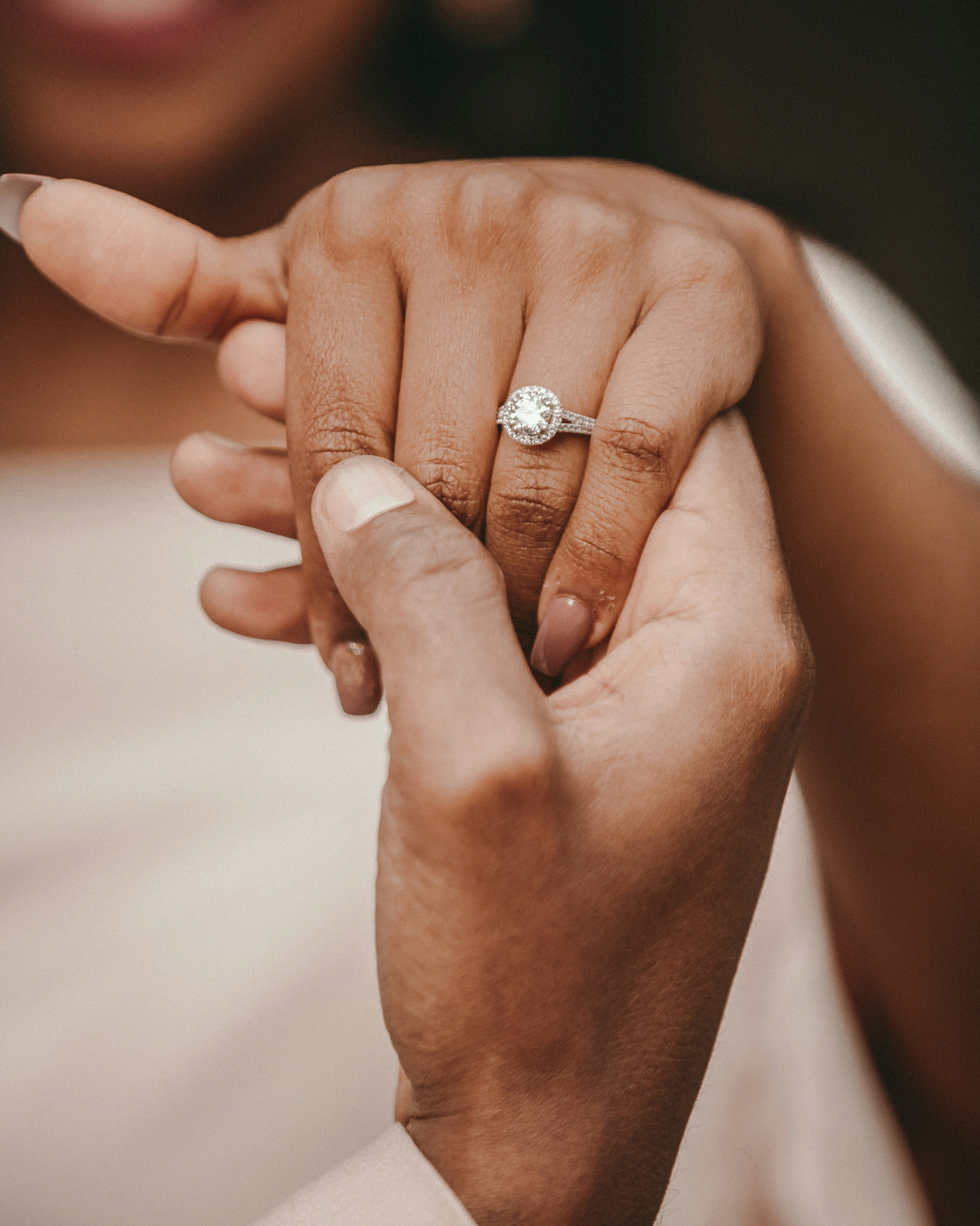 How Long Before Your Wedding Should You Have Anti-Wrinkle Injections?