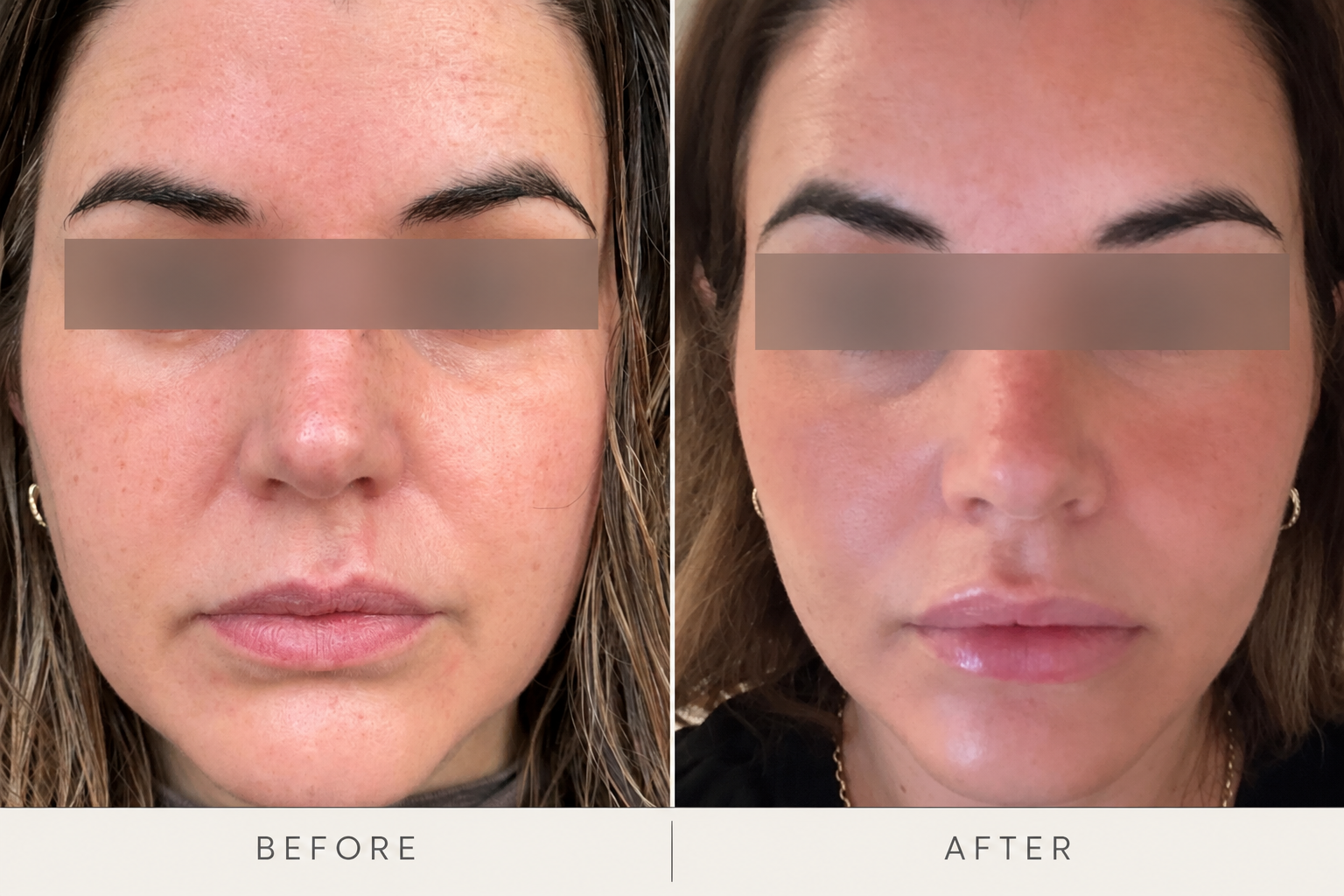 Before and after Obagi Nu-Derm showing brighter, more even-looking facial skin