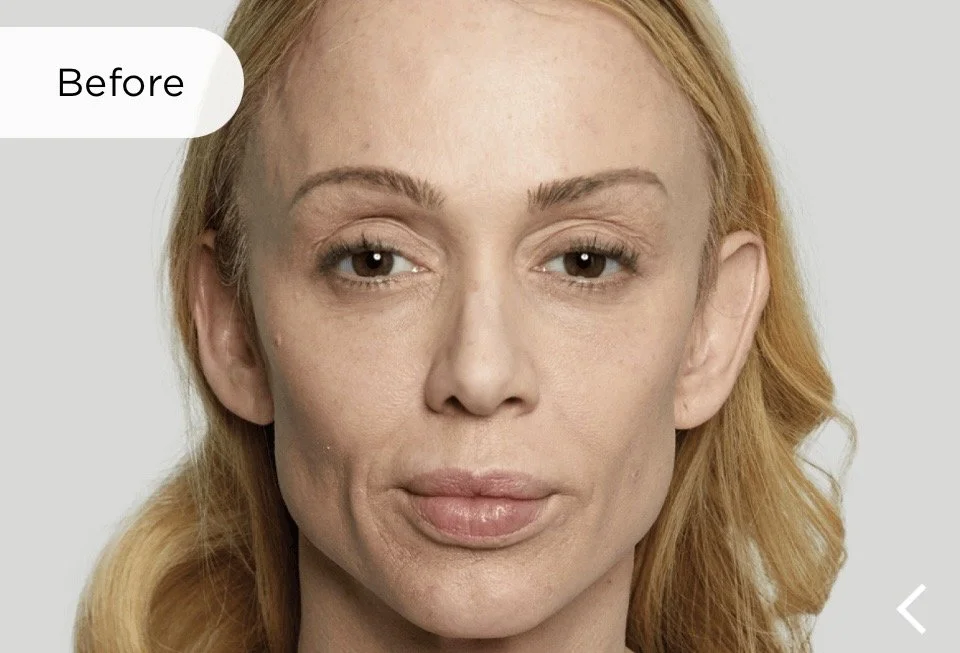 Before, Anna aged 43