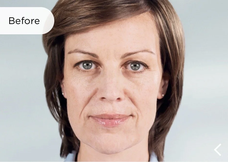Before, Franca aged 42