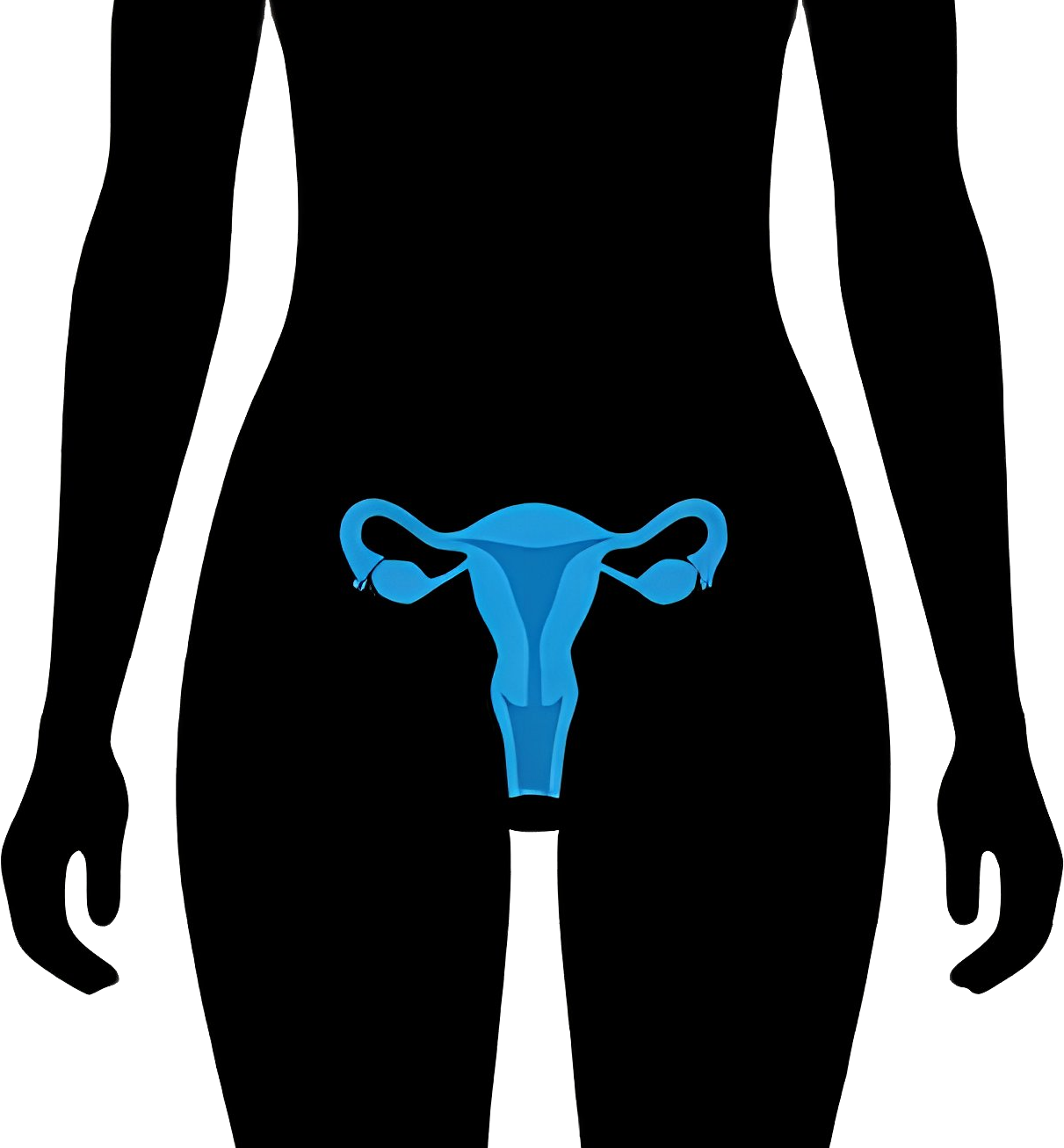 Gynecological Surgery