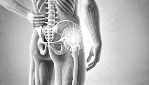 Why Lateral Hip Pain Is So Hard to Treat — and Why Rest Alone Fails