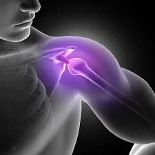 Rotator Cuff Surgery: What You May Not Understand (But You Need to Know)