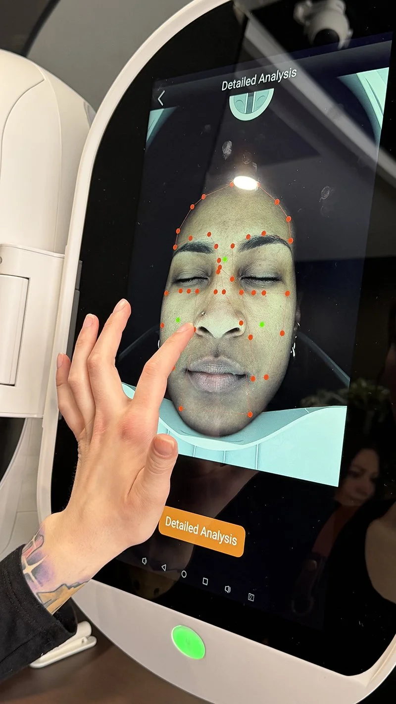 A person pointing at a facial analysis screen on a medical device, showing a detailed analysis of a person's face with marked points around features, likely for cosmetic or medical assessment.