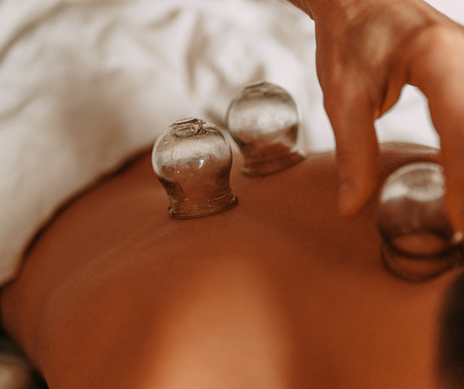 Cupping on Back