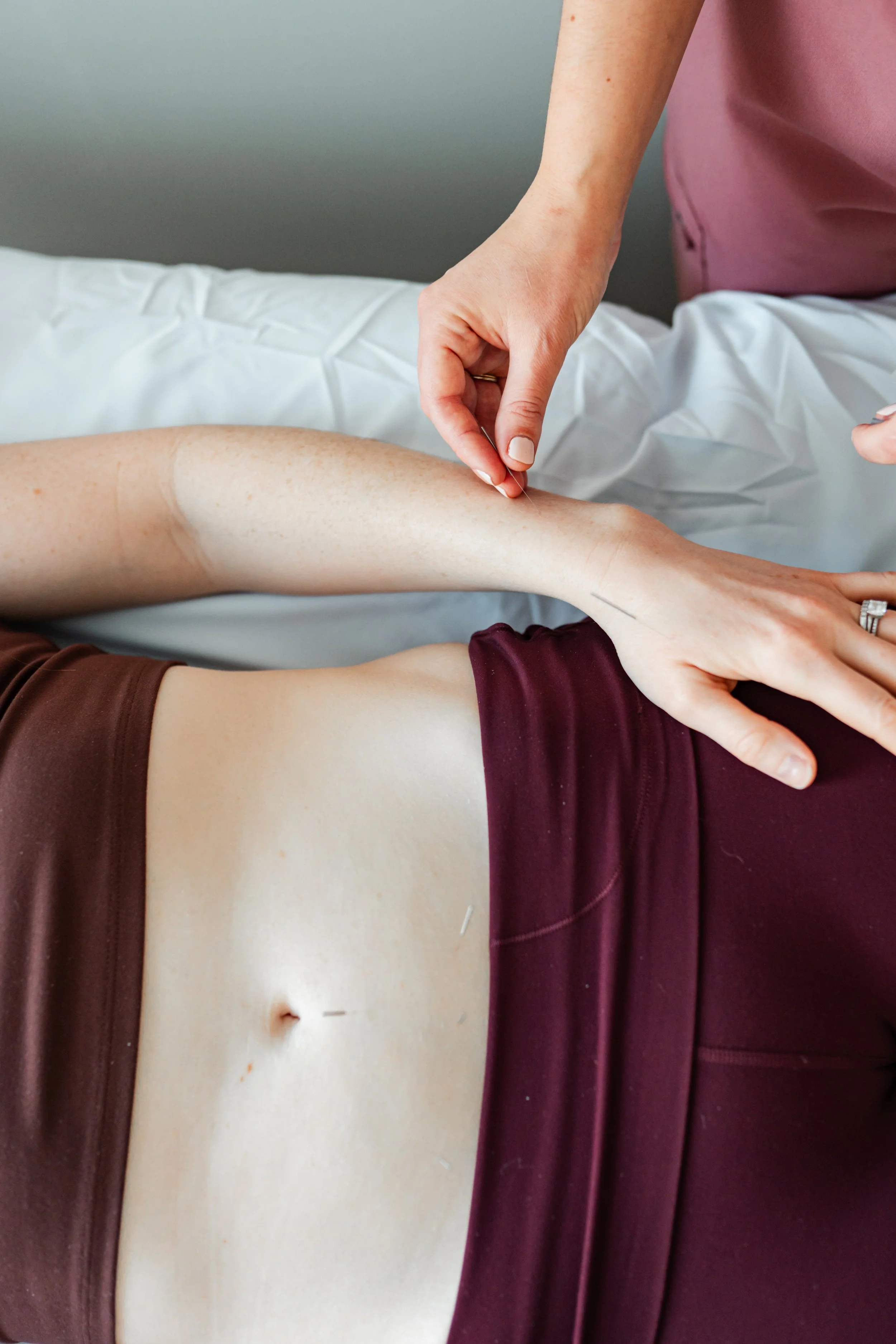 Acupuncture treatment at The Violette House for women seeking endometriosis support in Groton, MA