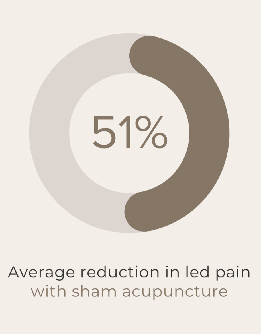 Acupuncture reduced average leg pain by 51% in a clinical trial of adults with sciatica