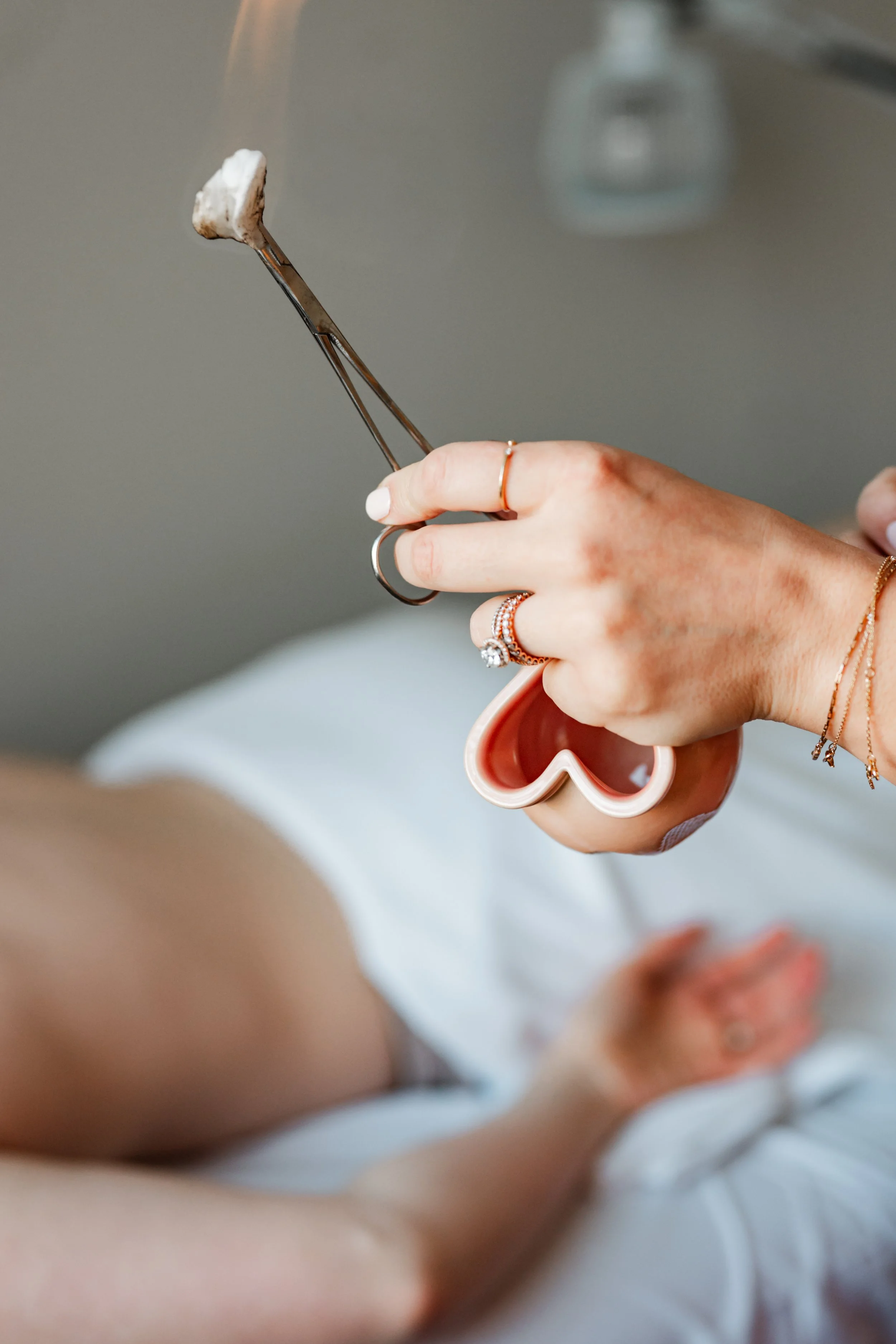 Practitioner preparing cupping therapy cups during an acupuncture session at The Violette House in Groton, MA