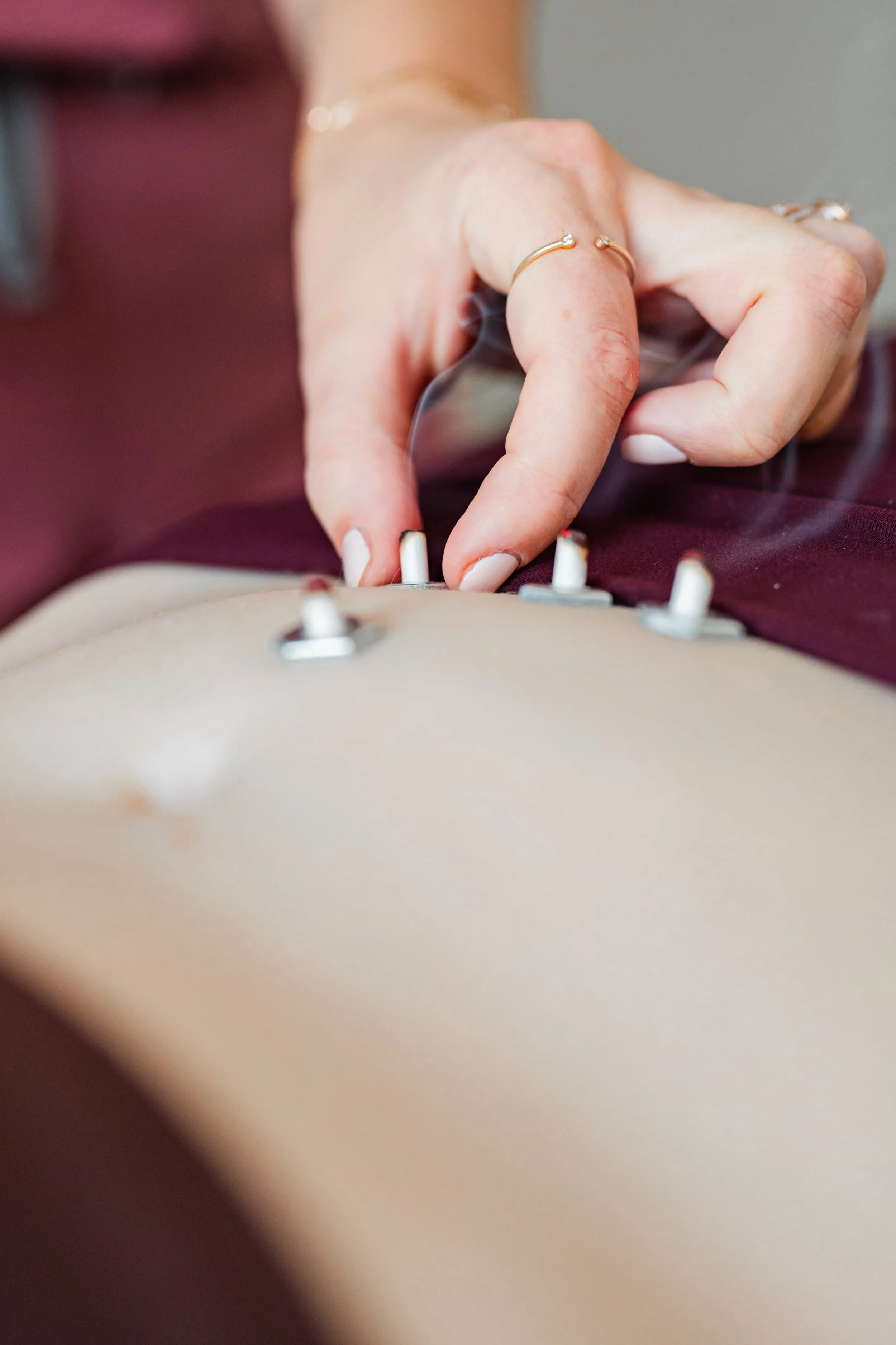 Fertility acupuncture treatment near Chelmsford, MA at The Violette House