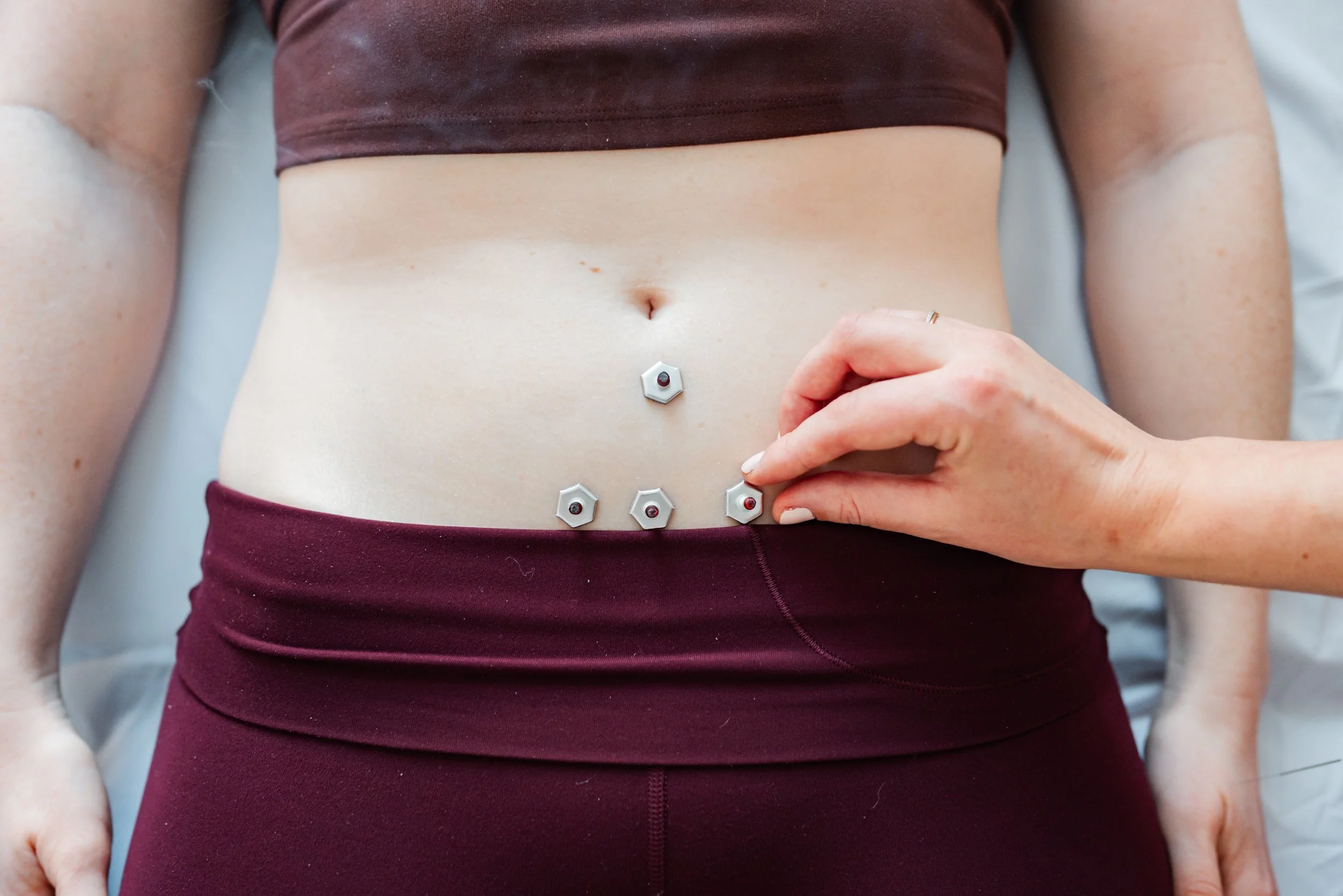 Fertility acupuncture treatment for patient near Leominster, MA