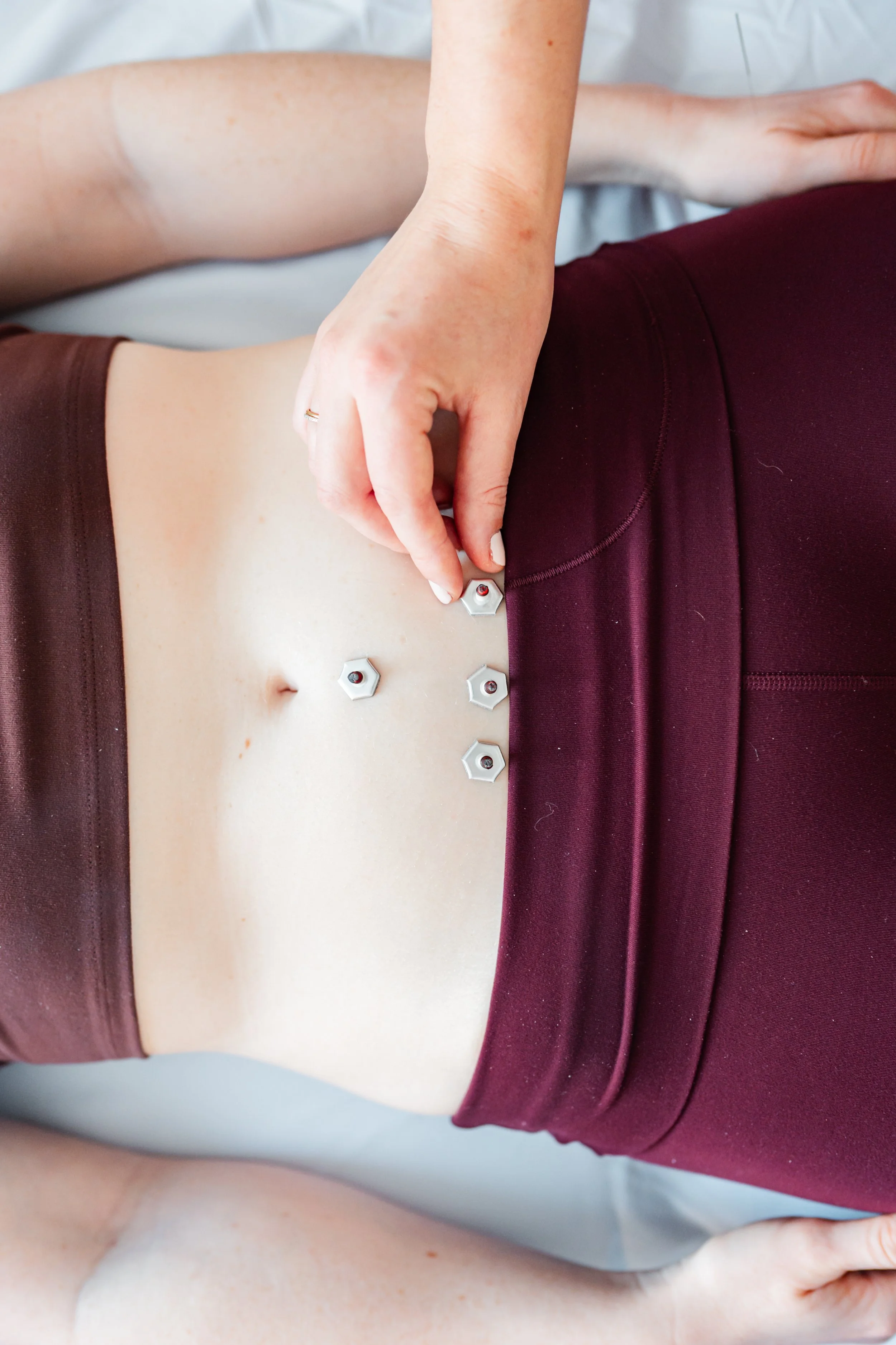 Moxibustion treatment applied to the abdomen during a fertility acupuncture session at The Violette House in Groton, MA