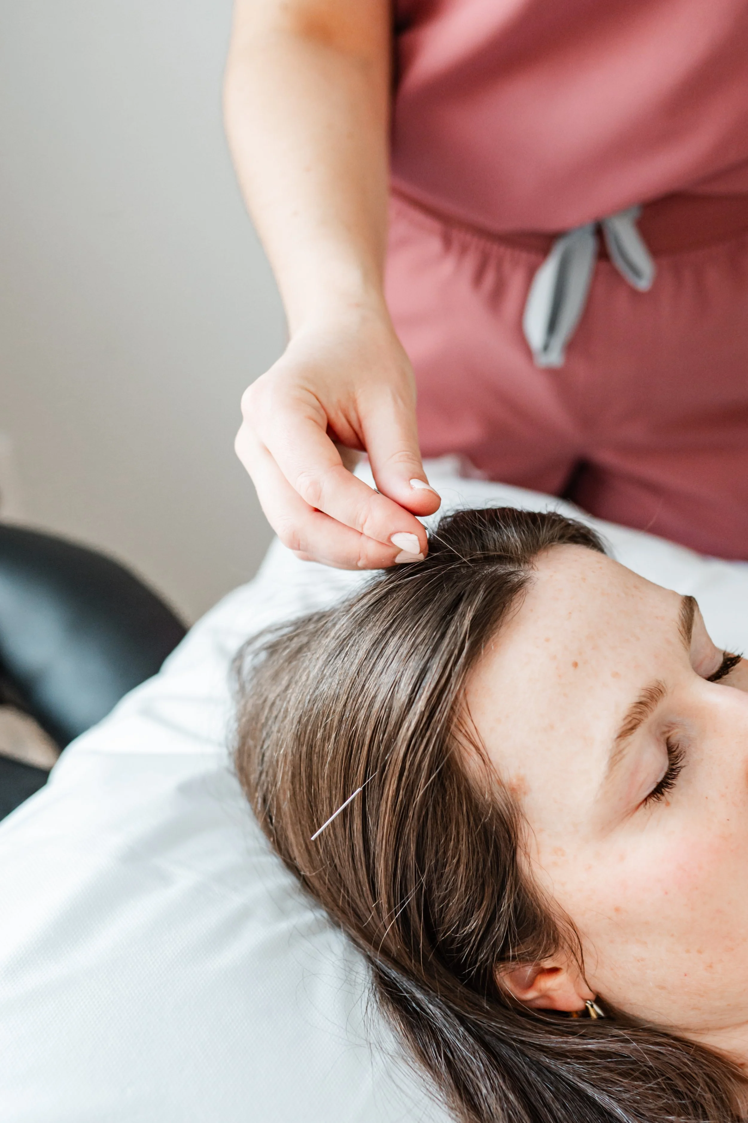 Acupuncture needles placed during a first visit session in Groton, MA