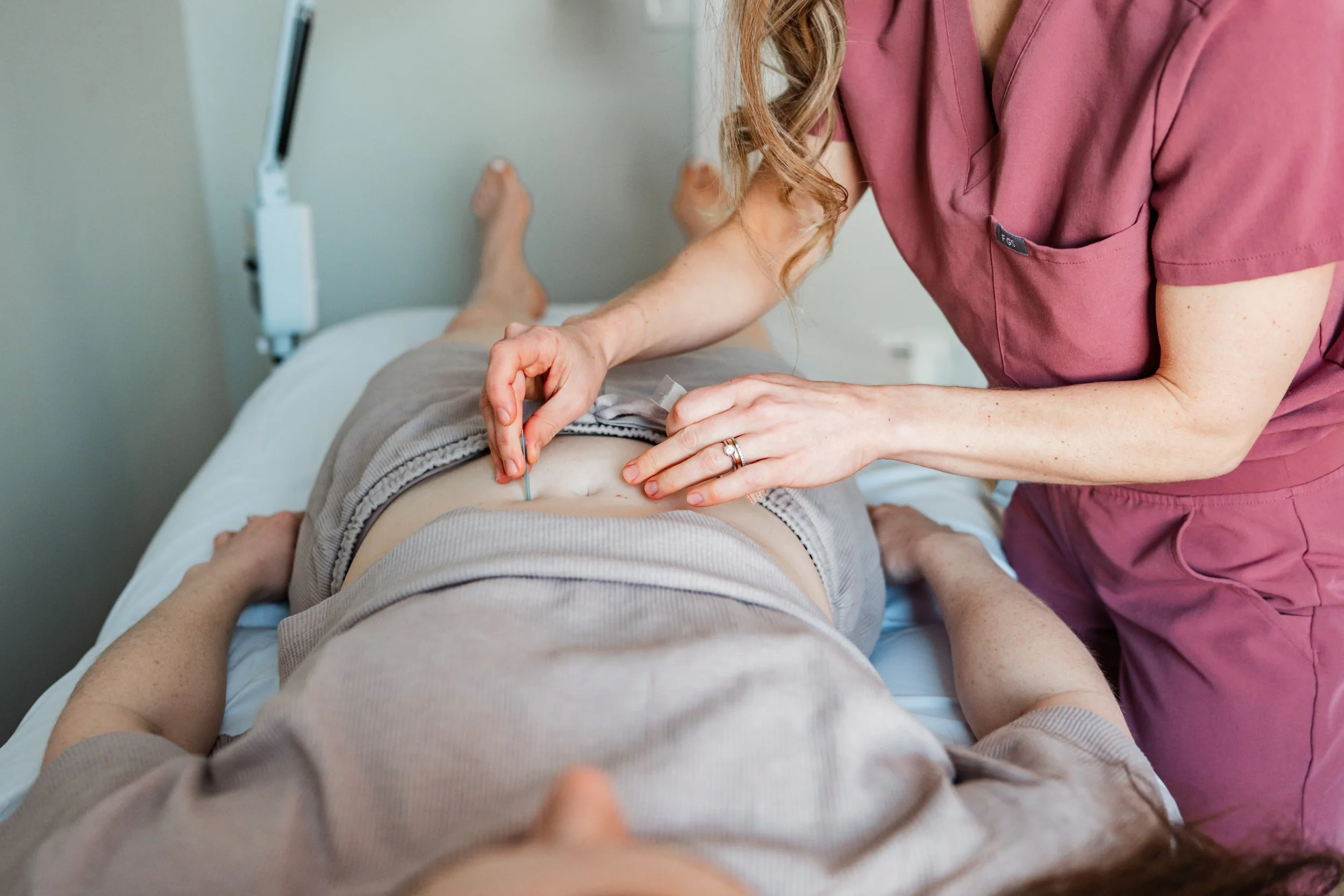 Acupuncture treatment to support fertility and reproductive health in Groton, MA