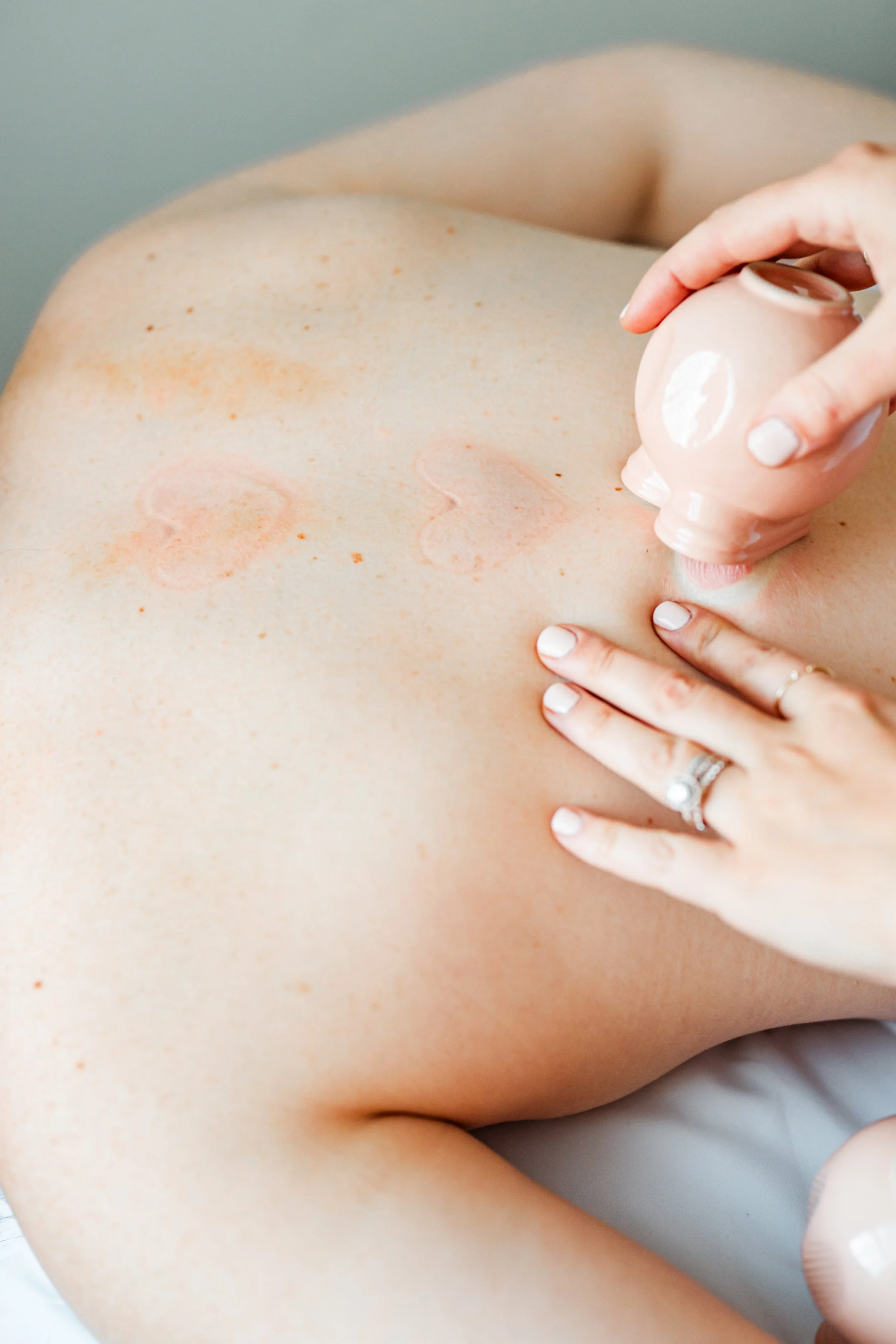 Client resting during an acupuncture treatment session with heat therapy in a Groton, MA clinic.