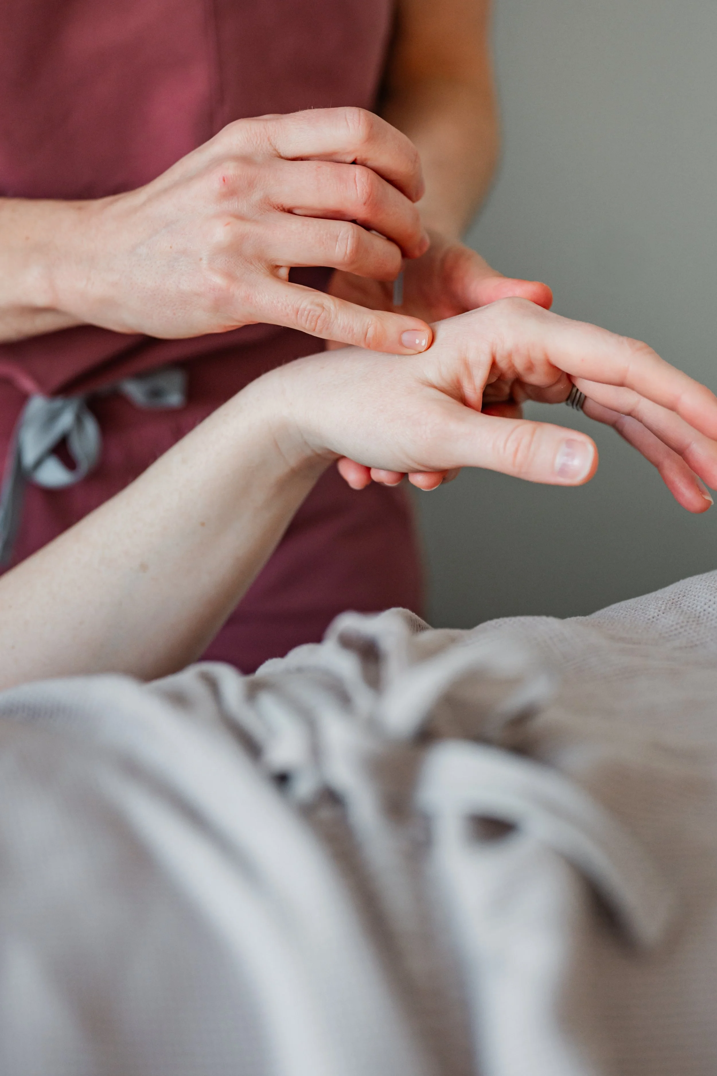 Acupuncturist gently placing needles on a patient's hand during a pregnancy nausea acupuncture treatment in Groton, MA