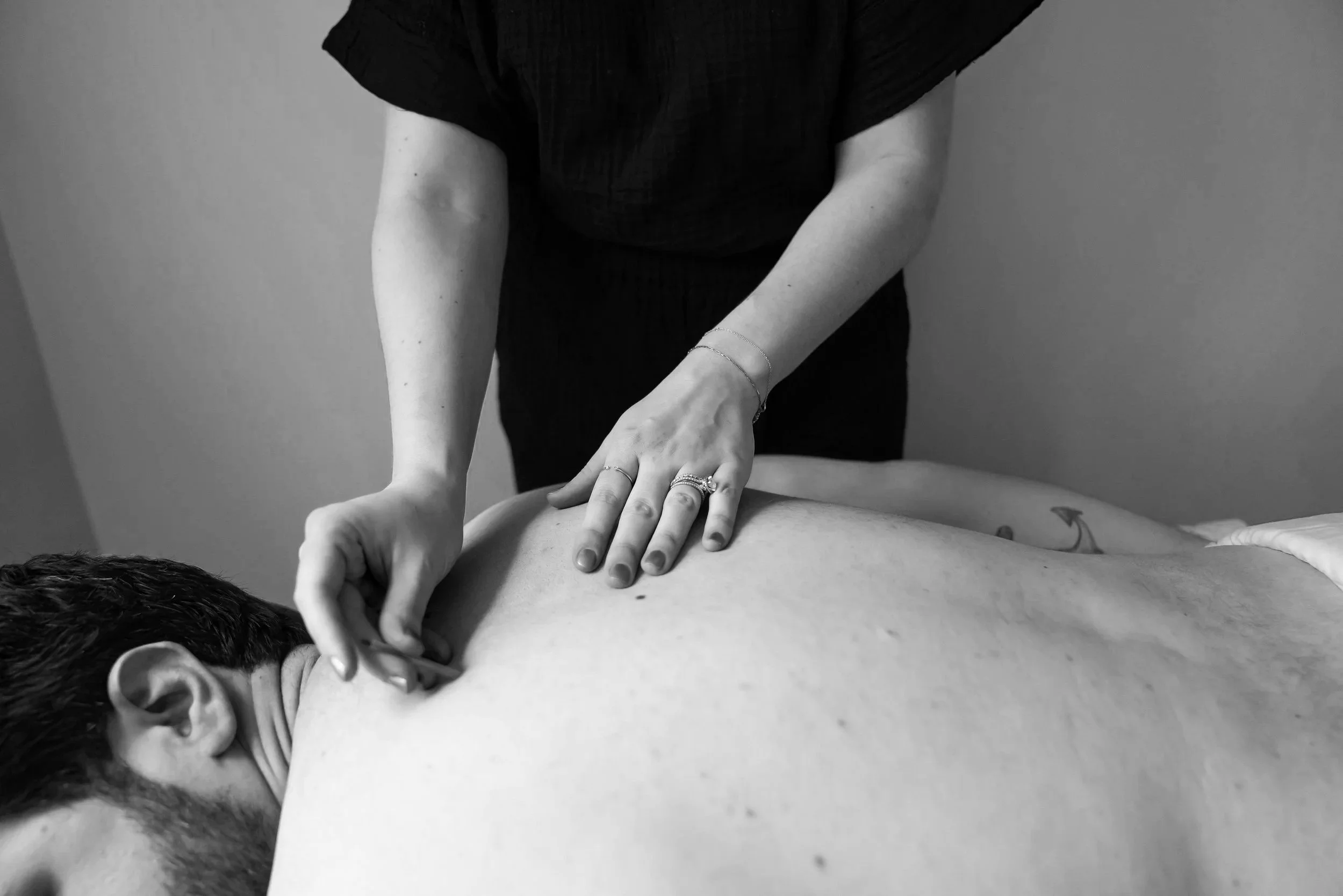 Back acupuncture treatment to support male fertility and overall wellness