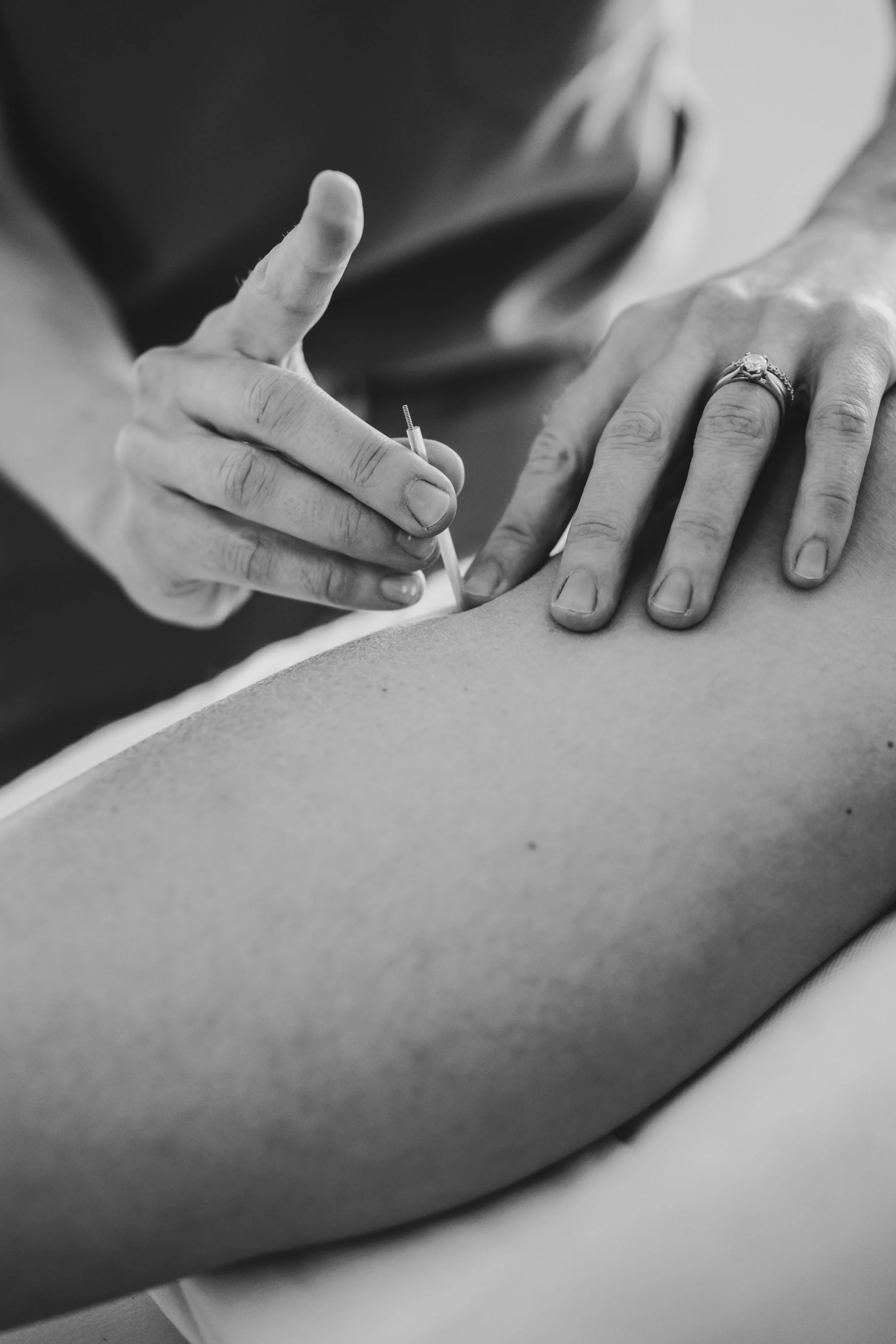 Labor support acupuncture treatment at The Violette House in Groton, MA